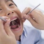 学校の歯科検診について